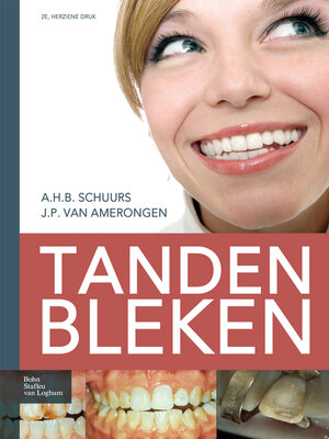 cover image of Tanden bleken